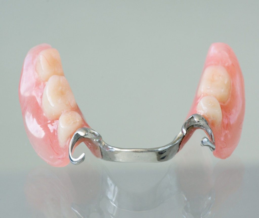 Partial-Dentures-Image4